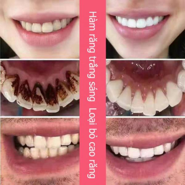 Kem Đánh Răng Làm Trắng Răng loại bỏ cao răng hôi miệng tẩy ố vàng Không Chứa Florua Kem đánh răng bạc hà 100g 5