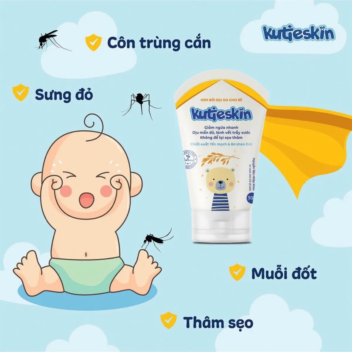 KUTIESKIN (tuýp 30gr) - Kem bôi dịu mẩn đỏ, dịu vết ngứa, hăm da, muỗi đốt, côn trùng cắn _ Chính hãng Cho Bé