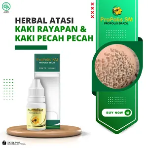 Propolis SM Atasi Kaki Rayapan, Kaki Berlubang, Kaki Pecah Pecah, Kaki Jamuran, Mata Ikan Di Kaki