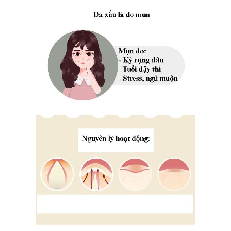 Set Miếng Dán Mụn Trong Suốt- Miếng Dán Hỗ Trợ Mụn- Miếng Dán Che Mụn- HICKIES LACING SYSTEM 5