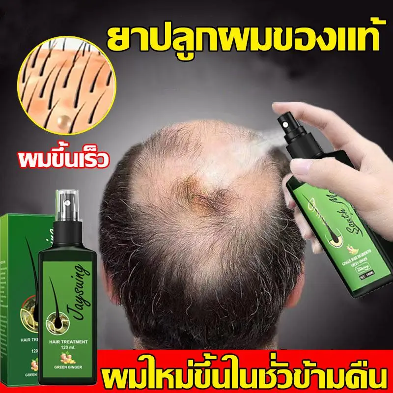 （7day หนาแน่น）เซรั่มปลูกผม น้ำยาปลูกผมดก น้ำยาเร่งผมยาว ยาปลูกผมของแท้ น้ำยาปลูกผมผู้ชาย  ทำให้รากผมแข็งแรงมากขึ้น