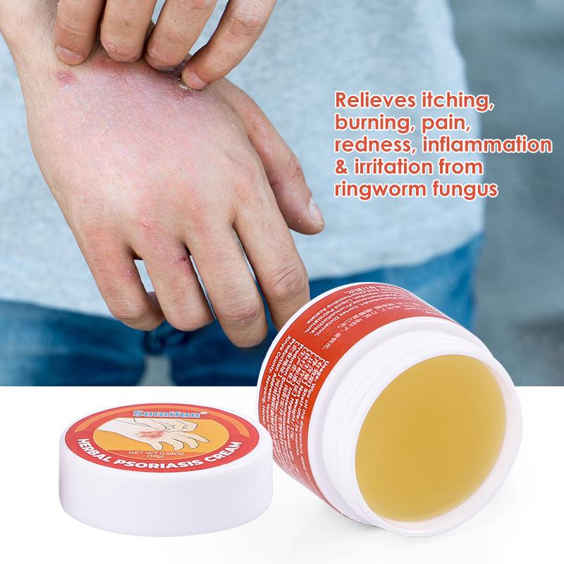 Kem Trị Viêm Da, 10g, Kháng Khuẩn, Chống Ngứa, Vết Bỏng, Kem Chăm Sóc Da 5