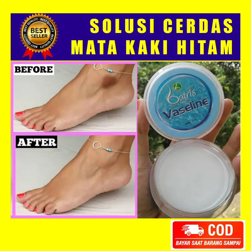 Perawatan Mata Kaki Hitam Ampuh 0