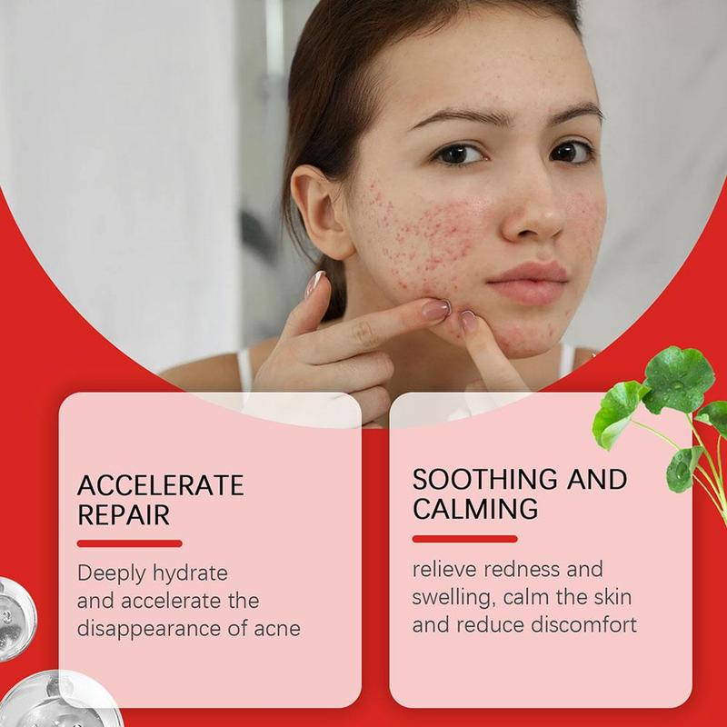 Product Introduction of 240pcs Salicylic Acid Acne Patch Colorful Heart Star Acne Shaped Pimple Patch N6S9 29