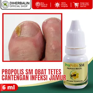 Pembentuk Kuku Rusak akibat Jamur Kuku Cantengan Jempol Kaki Bau Bernanah Bengkak