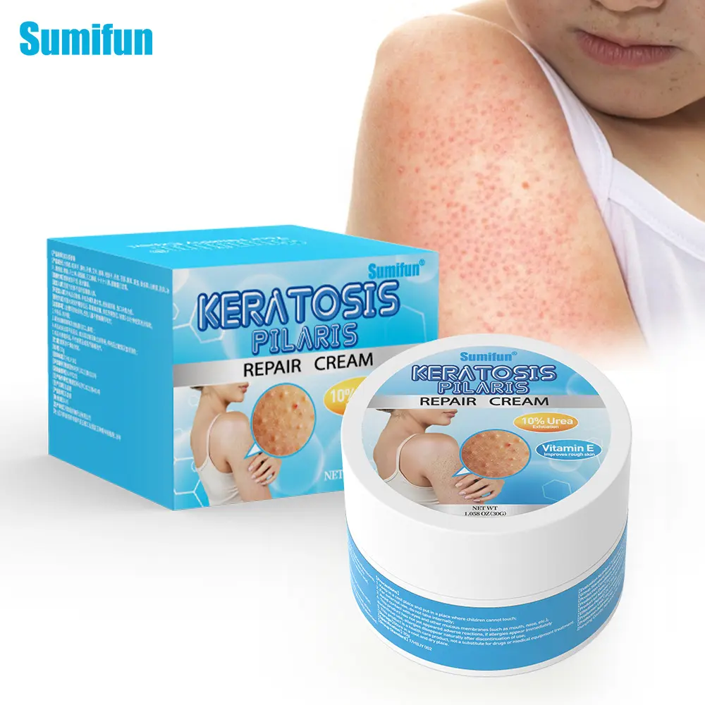 Vitamin E Chicken Skin Cream Urea Exfoliator Pimple Body Care Skin Repair Lotions Comfort Skin Care Cosmetic Moisturizers