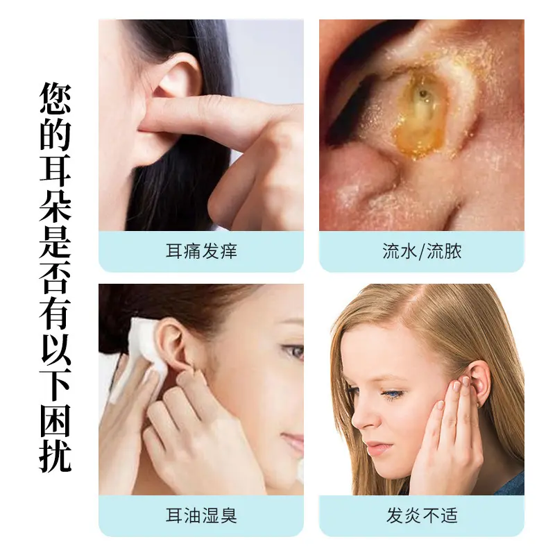 Chuanjing Hongyan Otkang Coptis Chinensis Ear Drop 20ml Ear Pain Itching Flowing Water Pus Meatus Acusticus Blocking Discomfort for External Use
