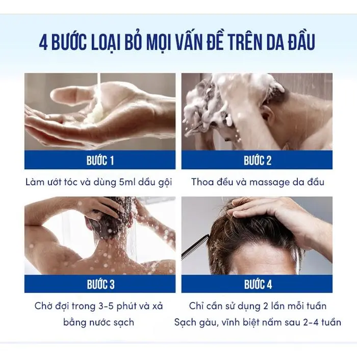 Dầu gội chống gàu Mochi Medical Nhật Bản dầu gội sạch gàu Mochi hết nấm ngứa trong 2 tuần 8