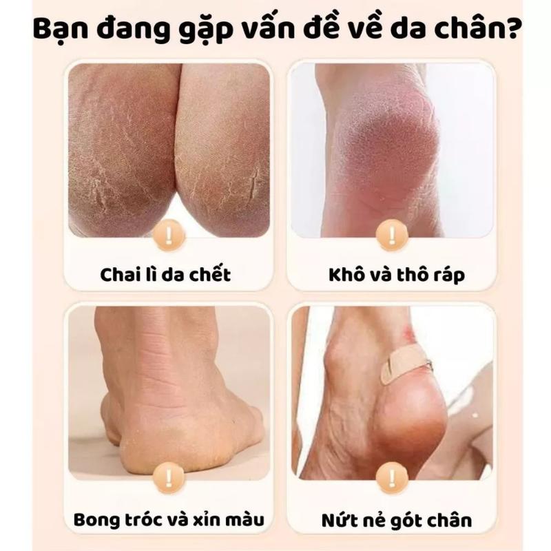 Tất Ủ Tay Silicon Ủ Kem Dưỡng Ẩm Chống Khô Da Nứt Nẻ Gót, Vớ Ủ Tay Chân Giúp Bảo Vệ Da Dưỡng Trắng Mềm Da 1