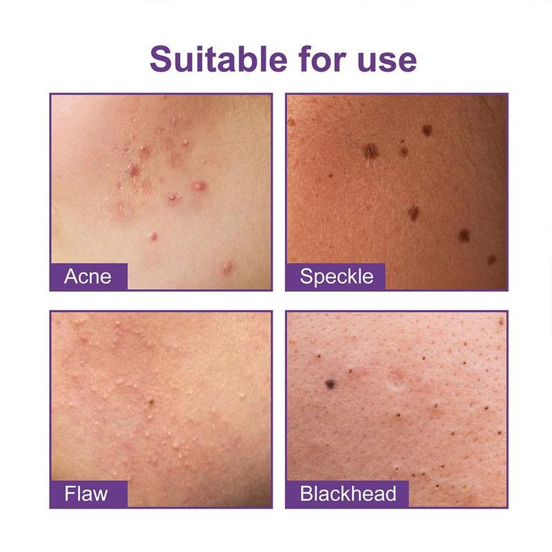 180pcs/box Hydrocolloid Acne Patch Pimple Repair Patch Ance Colorful Starry Care Face Sky L7K7 8