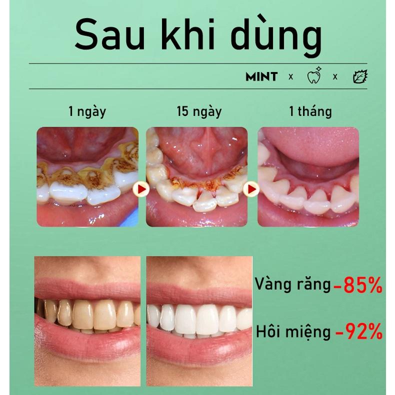 Kem Đánh Răng Làm Trắng Răng loại bỏ cao răng hôi miệng tẩy ố vàng Không Chứa Florua Kem đánh răng bạc hà 100g 4