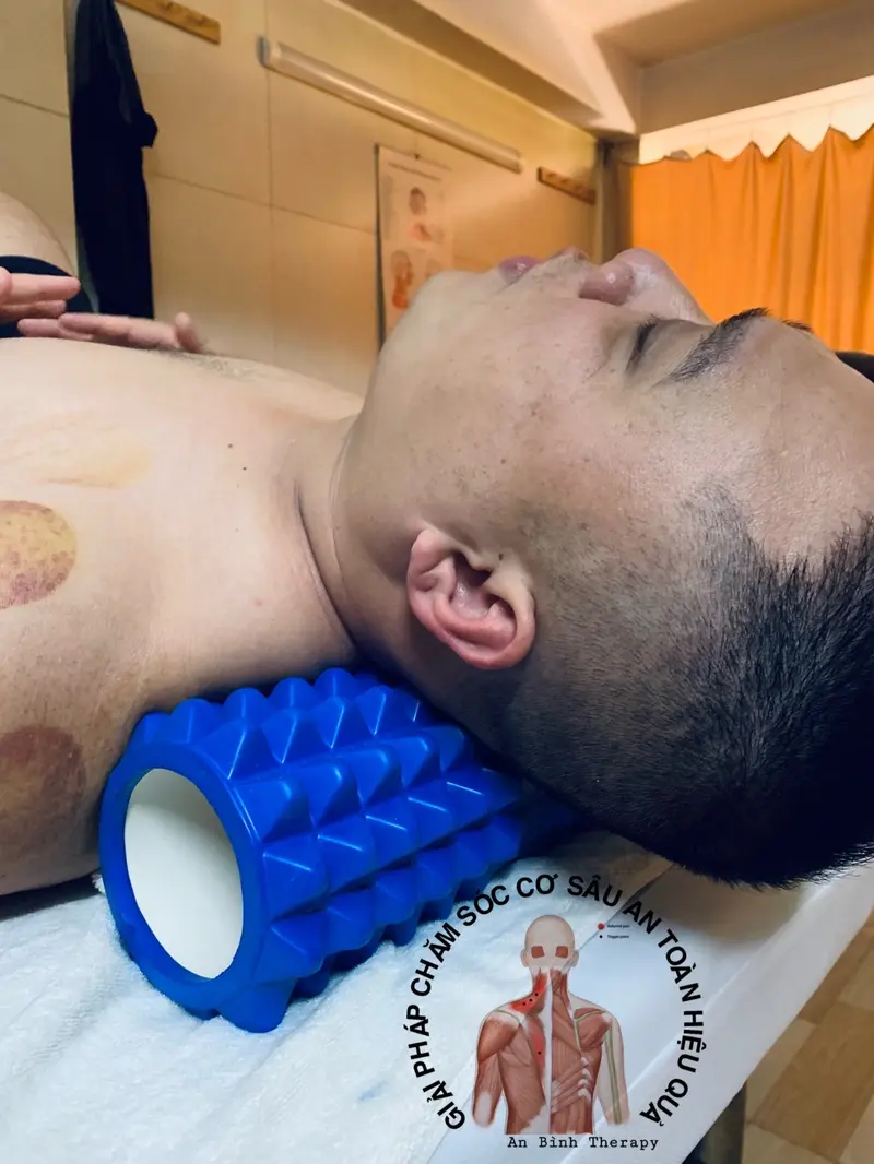 Product Introduction of Miếng dán ngải cứu vai gáy 7