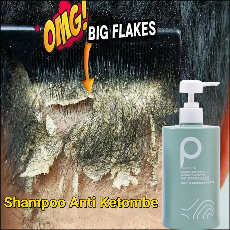 Shampoo Anti Ketombe Penghilang Ketombe Sampo Garam Laut Ketombe Rambut Berkerak Anti Tungau Shampo Kontrol Minyak