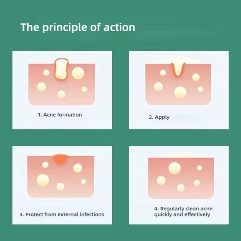 Product Introduction of 🔥Hot Sale🔥 36PCS Waterproof Acne Pimple Patches Hydrocolloid Stickers Pimples Removal Facial Skin Care 31