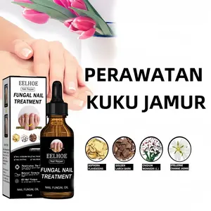 Cairan perbaikan kuku lembut, cairan perbaikan kulit mati, pelembab, nutrisi kuku, cairan perawatan kuku Nail