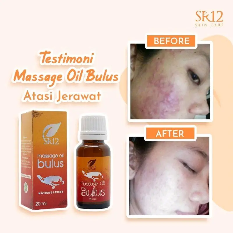 Minyak Bulus SR12 Aroma Melati Massage Oil Bulus SR12 Penghilang Stretchmark 6
