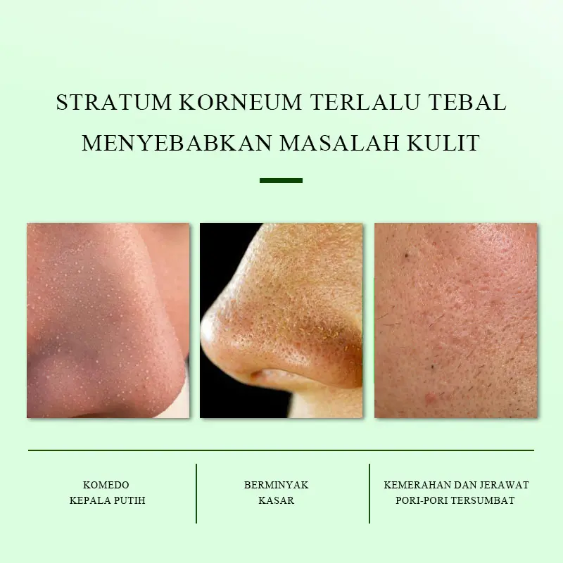 【Beli 1 Gratis 1】SHE Eureka Chlorella Exfoliating Gel Facial Glowing Blackhead Cleaner Body Exfoliating Mencerahkan Dan Mengangkat Sel Kulit Mati 1