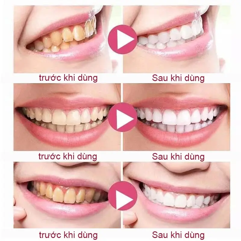 Gel nano bạc GAOLIBAI đánh bật cao răng sạch mảng bám trắng răng cho hơi thở thơm mát, GAOLIBAI chính hãng 120g 3