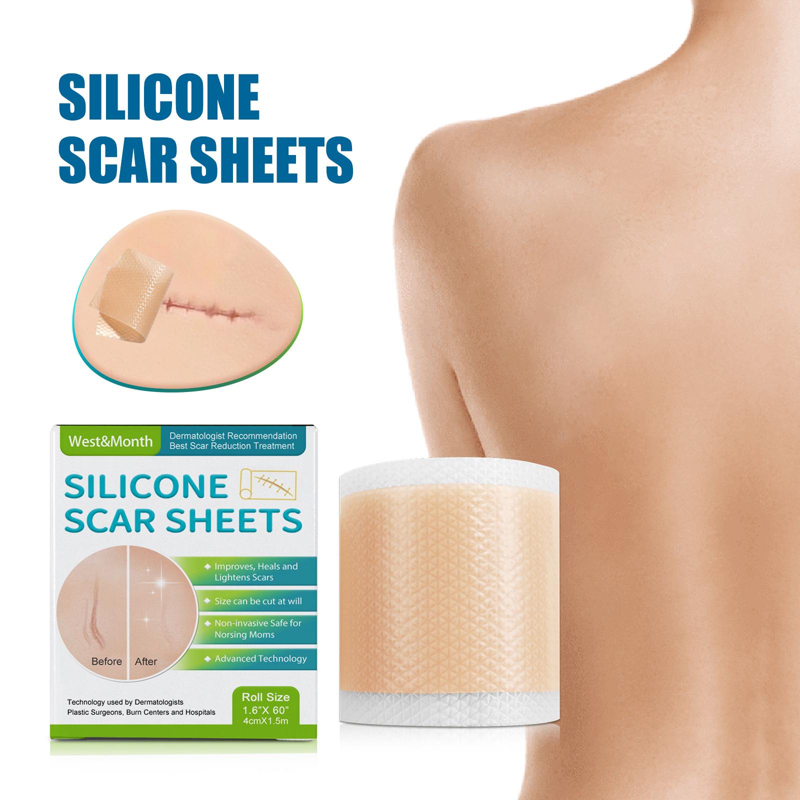 Silicone Scar Sheet Surgical Scar Cesarean Scar Covering Sticker ...