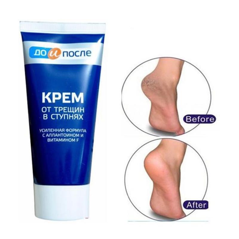 Kem dưỡng giảm nứt gót chân Kpem Apteka của Nga (tuýp 50ml) Dưỡng Da Tay kem  duong