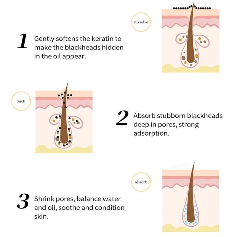 Product Introduction of RtopR Cleaning Pores Peeling Off Nose Mask Mango Blackhead Mask Shrink Pores Serum Skincare 24