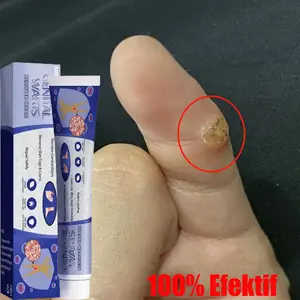 Salep Obat Kutil Paling Ampuh, Wart Removal Cream Krim Penghilang Lalat, Krim Penghilang Kutil, Mudah Dibawa Untuk Semua Kulit, Krim Penghilang Kutil