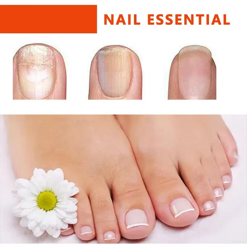 Tinh Dầu Dưỡng Móng, 10ml, Thích Hợp Cho Mọi Loại Da, Sửa Chữa Móng Tay Và Vỏ Sâu, Ngăn Ngừa Gãy Rụng Và Bong Vảy, Tăng Độ Cứng Của Móng 5