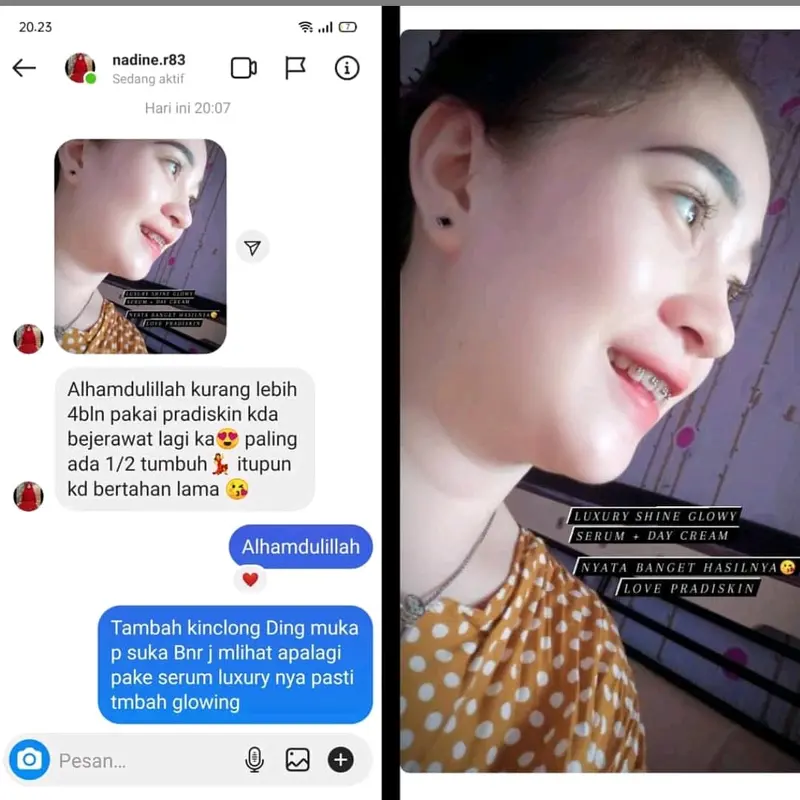 LUXURY SHINE GLOWY SERUM Pradiskin Glow untuk wajah 4