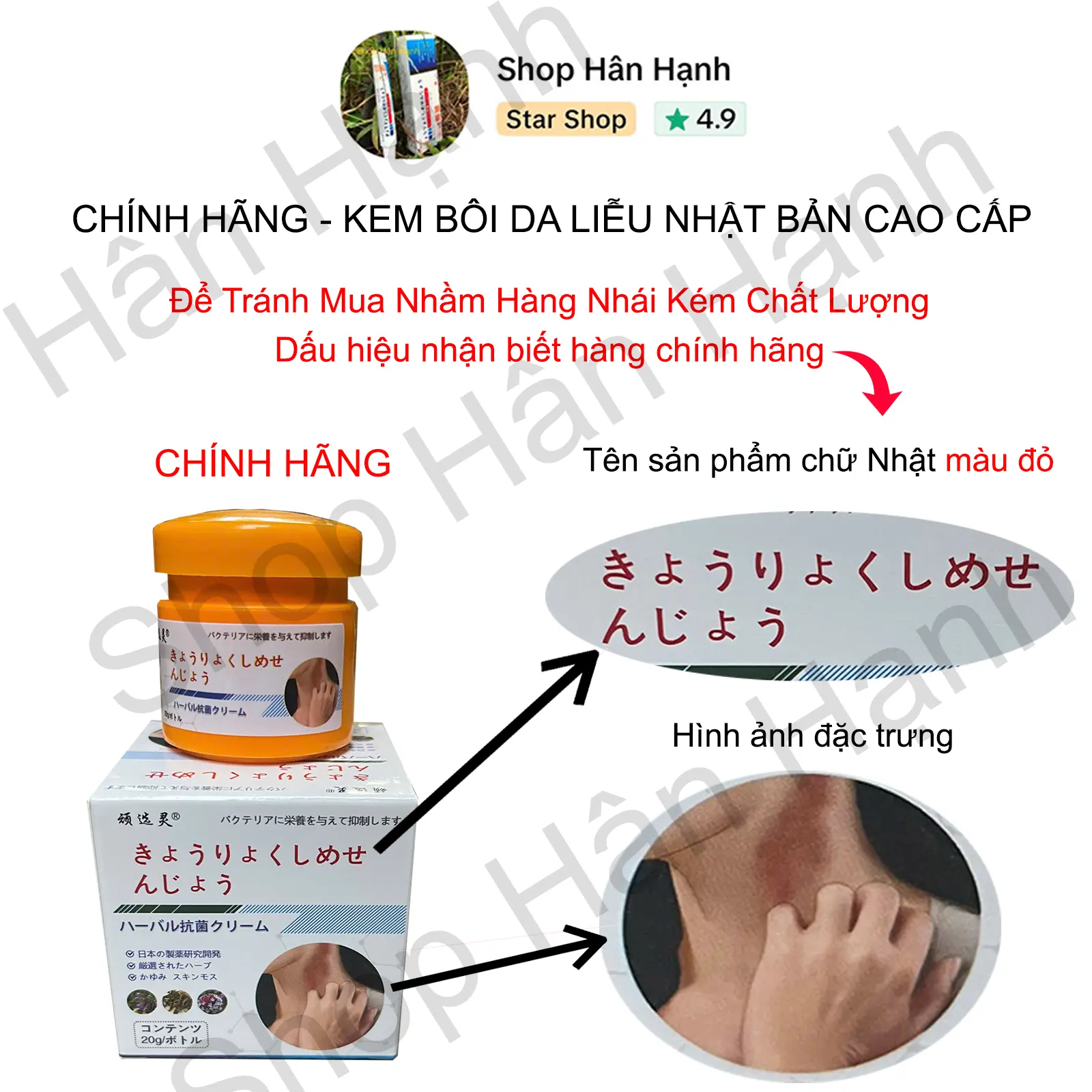 (Shop Hân Hạnh) Kem Nhật: á sừng,vảy nến,viêm da,ghẻ nước,hắc lào,lang ben,tổ đỉa