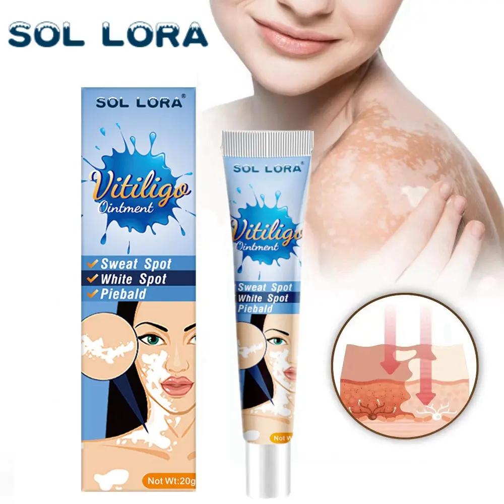 White Spot Cream Sweat Spot White Spot Flower Spot Efficacy on Skin Cream 20G