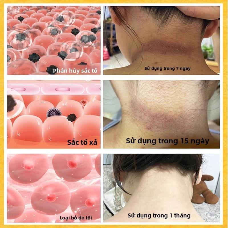 Kem Dưỡng Trắng Da Toàn Thân, Cho Nách, Đầu Gối, Cổ Và Mông, Thích Hợp Cho Các Bộ Phận Riêng Tư, Với Tinh Chất Tẩy Trắng, Công Thức Sương Mù, Thích Hợp Cho Đùi Trong, Làm Mờ Melanin Đen Và Làm Sáng Da, Chăm Sóc Da 1