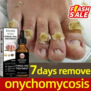 [LOW STOCK] EELHOE Obat Jamur Kuku Perawatan Jamur Kuku Paronychia Perawatan Lumut Kuku Obat Kuku Jamur Dan Rusak Nail Care Anti Jamur Perawatan Kuku Obat Kuku Berjamur Penghilang Jamur Anti Infeksi Obat Bengkak Obat Kuku Kaki , NailCare Cairan Kering