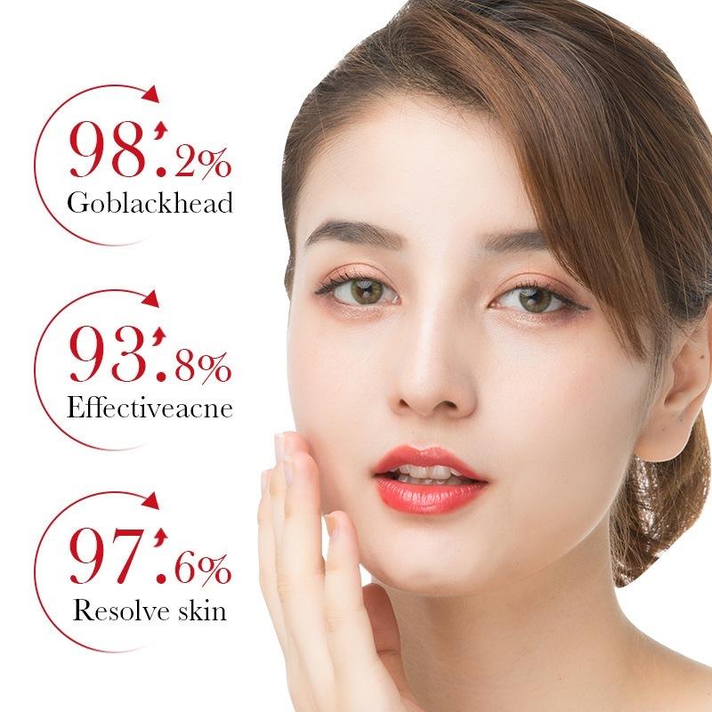 Kem loại bỏ mụn axit salicylic nhanh chóng loại bỏ mụn bọc Giảm Mụn Đầu Đen Và Mụn Trứng Cá 20g 2