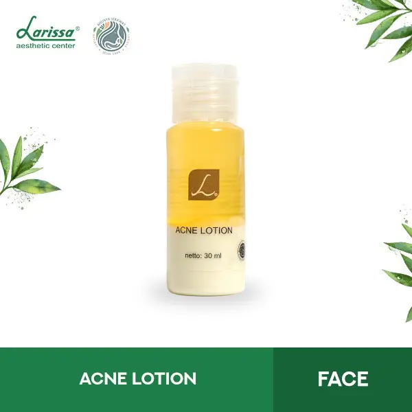 ACNE LOTION (ANTI JERAWAT) LARISSA