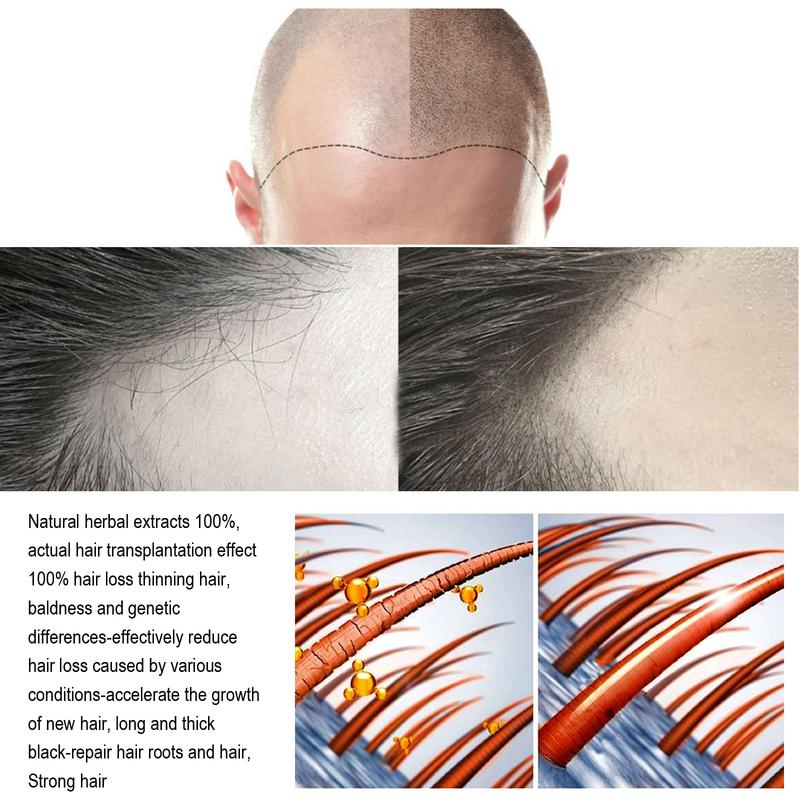 Product Introduction of 100% Original Brand JAYSUING Hair Care Solution Gentle Nourishing Massage Scalp Moisturizing Soft Spray 3