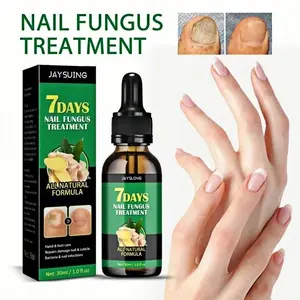 Perawatan Jamur Kuku 7 Days Nail Fungus Treatment Pengobatan Jamur Kuku & Perawatan Kuku Rusak Minyak Kutikula Jahe & Kunyit Menghidrasi & Memperbaiki Kuku Rusak Mengurangi Peradangan 30ml