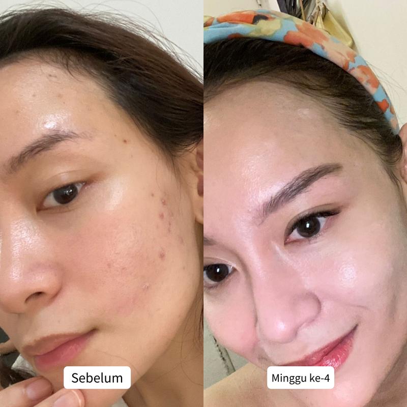 CALLISTA Brightening Essentials Package - Paket Basic untuk Mencerahkan 2