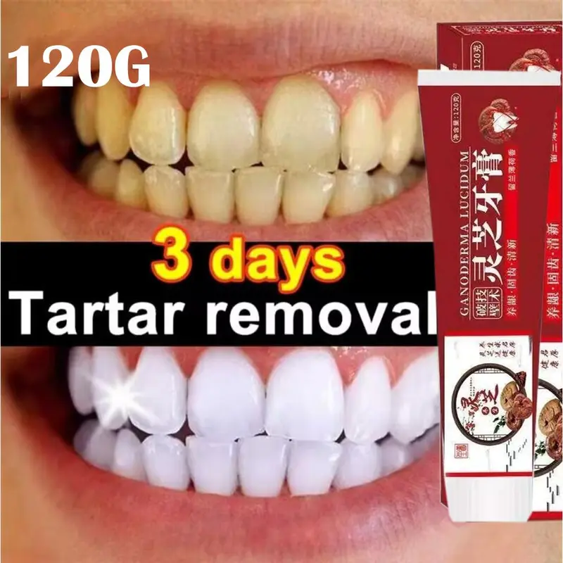 Ganoderma Lucidum Pasta Gigi, Perlindungan Gusi Multi Efek Pemutih Gigi Toothpaste Anti Bacterial Pasta Gigi Antibakteri Fresh Protection with Ganoderma Pasta Gigi Anti-cavity Tooth paste Whitening Power Pasta Gigi 0