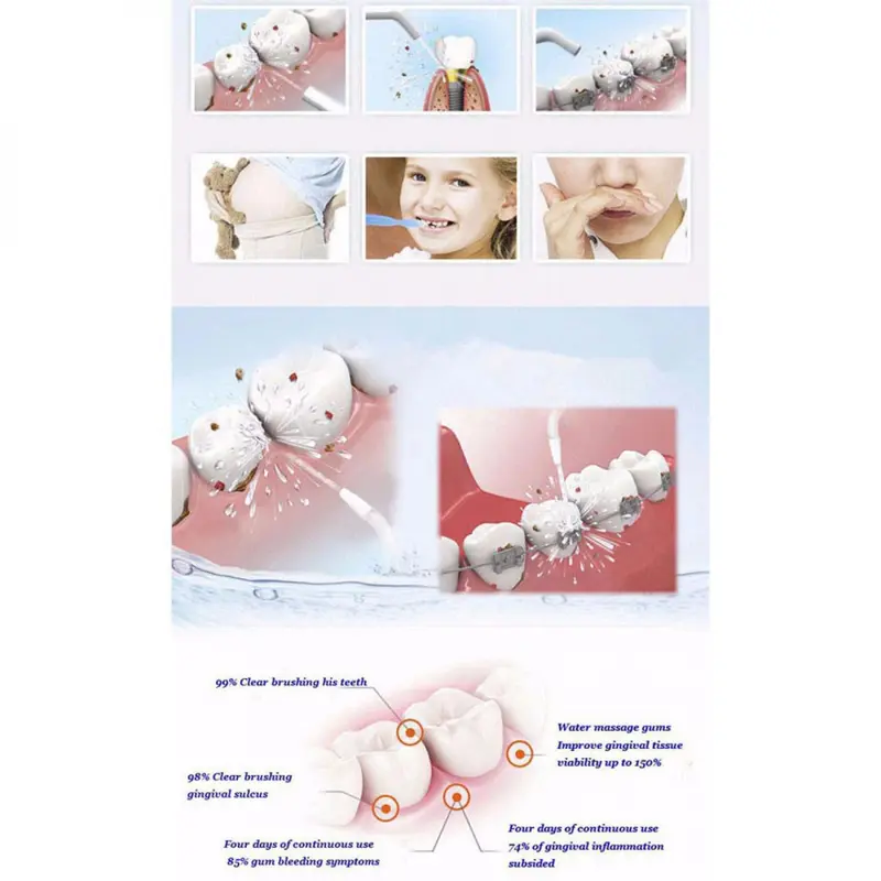 AZDENT Semprotan Pembersih Sela Gigi Dental SPA Water Floss - SP-001 6