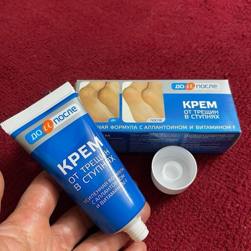 Kem bôi nứt , nẻ gót chân kpem hàng nga 50ml 2