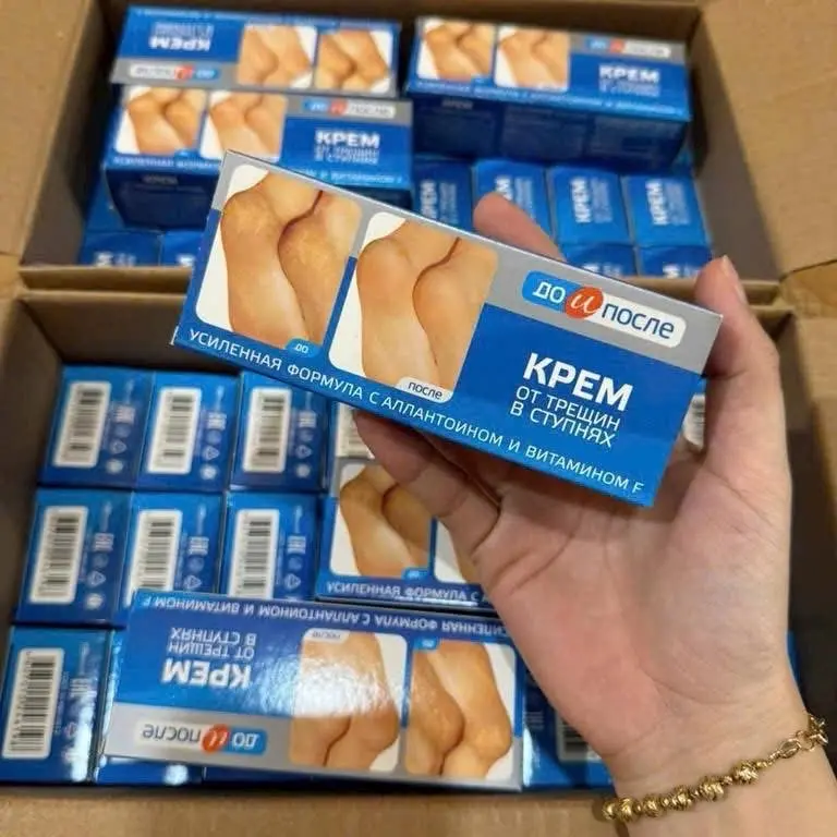 Kem bôi nứt , nẻ gót chân kpem hàng nga 50ml