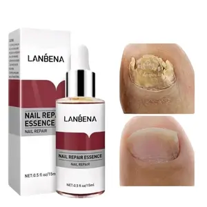 Serum Jarum perawatan kuku Lambena Nail Treatment