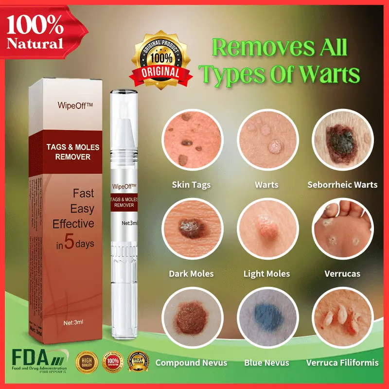 Warts Remover Cream Original Watson Warts Removal Mole Remover Organic Cream Skin Tags and Warts Remover Original