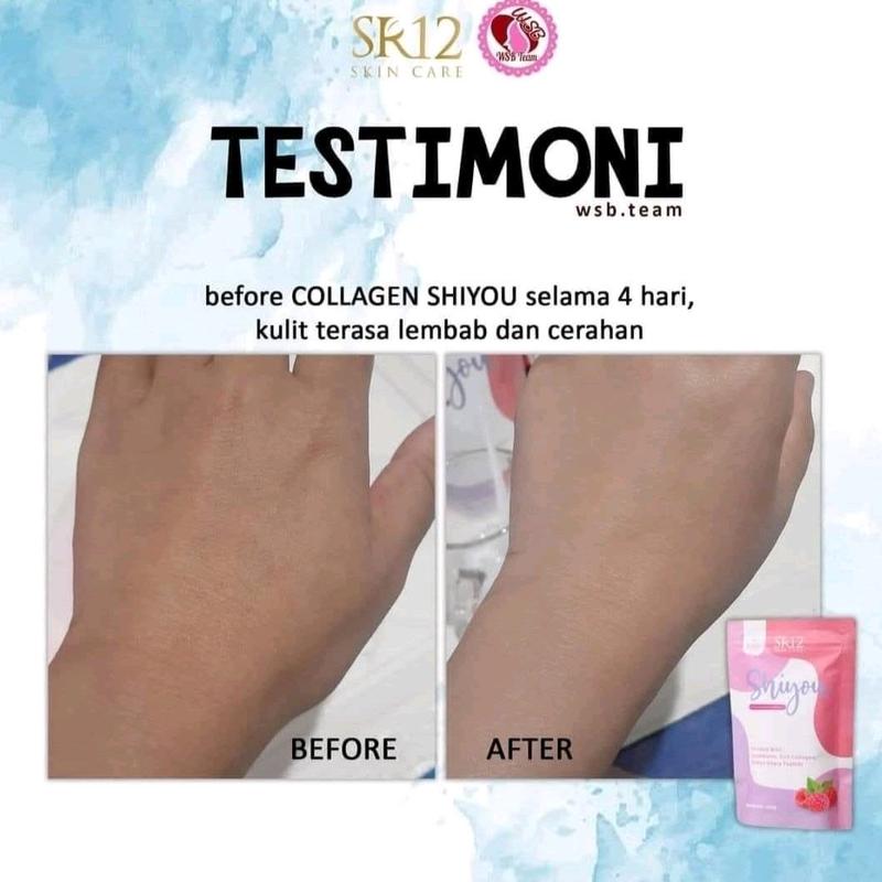 Shiyou Collagen SR12 Dewasa 2