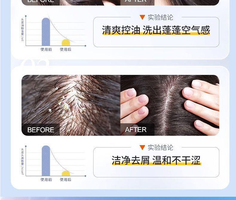 Product Introduction of Xikangwang Anti-Dandruf and Relieve Itching Washing Water Oil Removing Refreshing Skin Washing Cream Anti-Mite Grease-Overflow Moss Lotion 13