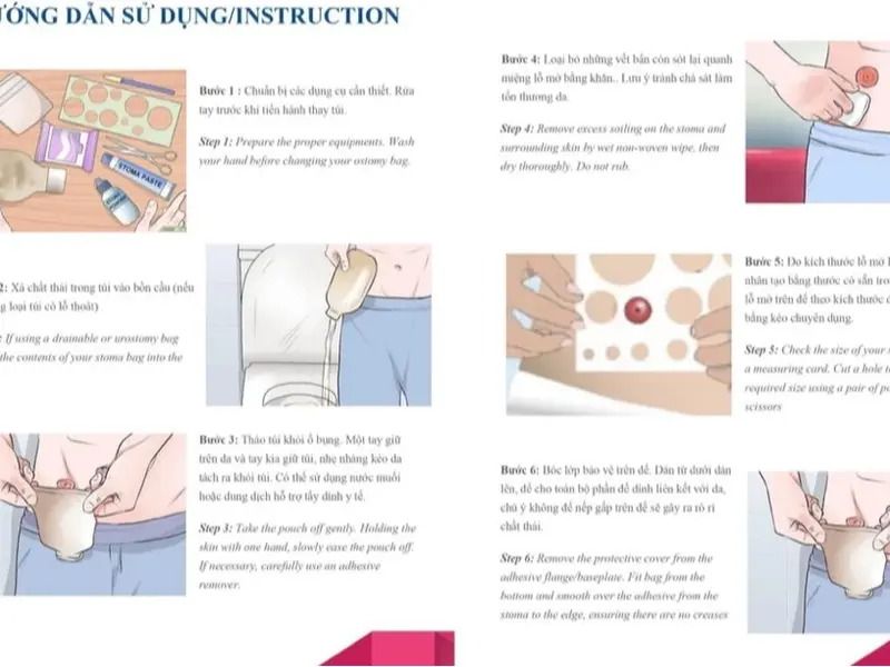 TÚI HẬU MÔN NHÂN TẠO, TÚI ĐỰNG DỊCH- TỔNG KHO SỈ, LẺ 1