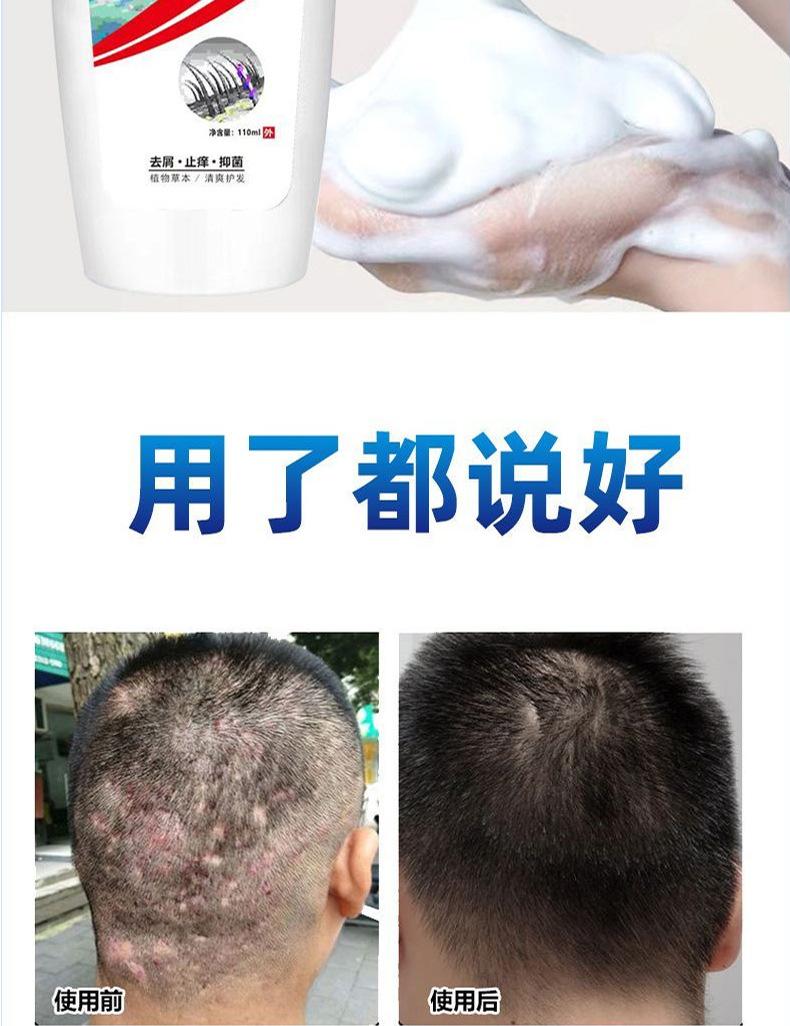 Product Introduction of Xikangwang Anti-Dandruf and Relieve Itching Washing Water Oil Removing Refreshing Skin Washing Cream Anti-Mite Grease-Overflow Moss Lotion 23