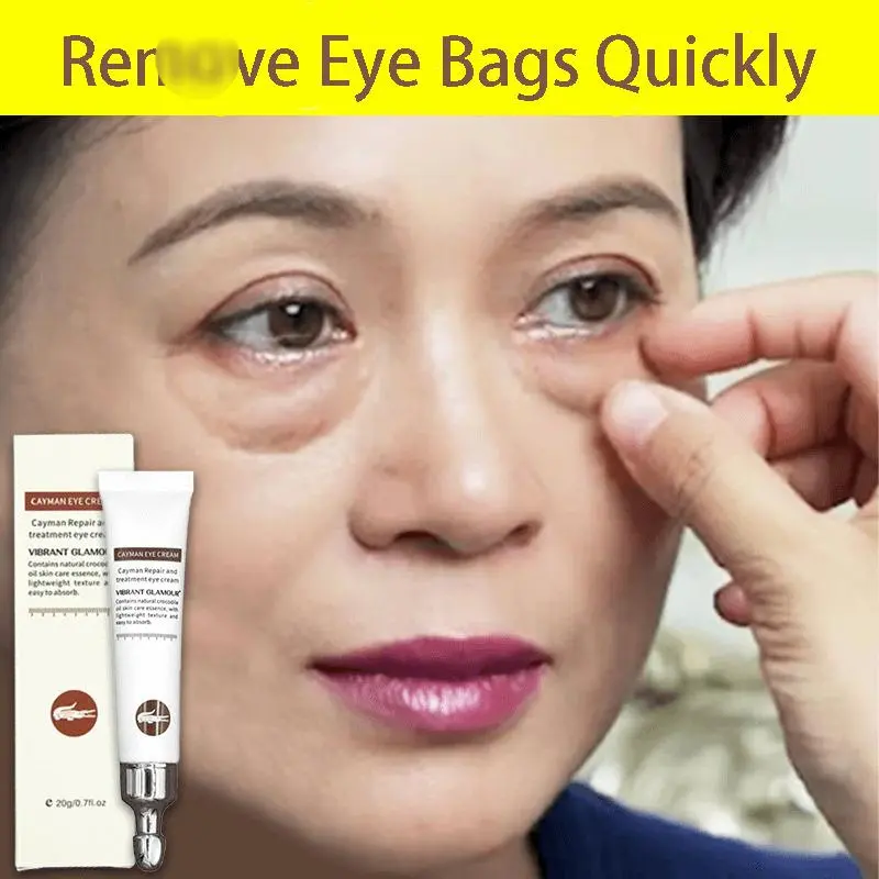 for eyebags remover eye cream for dark under eyebag cream remover eyebags remover original for wrinkles eyebag eyebugs remover anti-aging for woman instant eye tightener collagen eye cream ys007