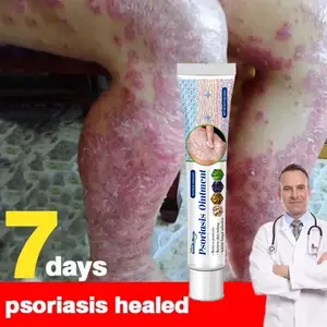 Krim Anti-Kudis untuk Kurap, Kaki Atlet, dan Kurap Selangkangan, Pereda Gatal Cepat, Perbaikan Kulit Mengelupas dan Retak, Krim Herbal Lembut Tidak Mengiritasi untuk Kurap, Cepat Meredakan Gatal pada Kulit, Menghilangkan Kutil, Cocok untuk Pria dan Wanita