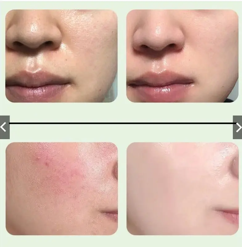 Gel tẩy da toàn thân - Chiết xuất nha đam 3